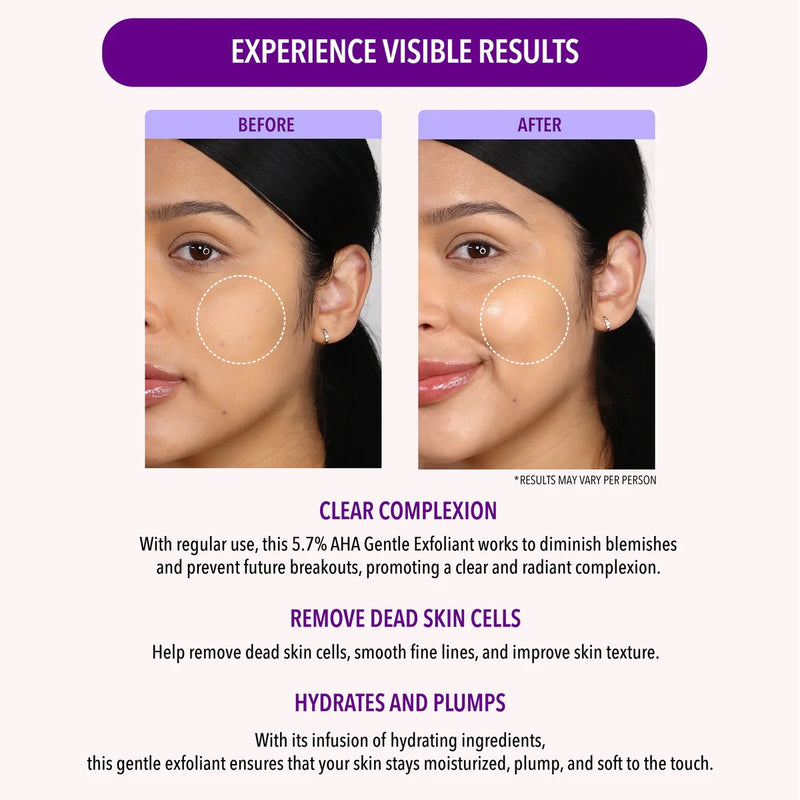 Load image into Gallery viewer, Skincare- MOIRA 5.7% AHA GENTLE EXFOLIANT OCE001 (3pcs bundle, $7.50 each)
