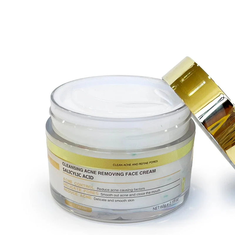Load image into Gallery viewer, Skincare-Simply Bella Acne Removing Face Cream Salicylic Acid SIB1019 ($3 each, 4pc bundle)
